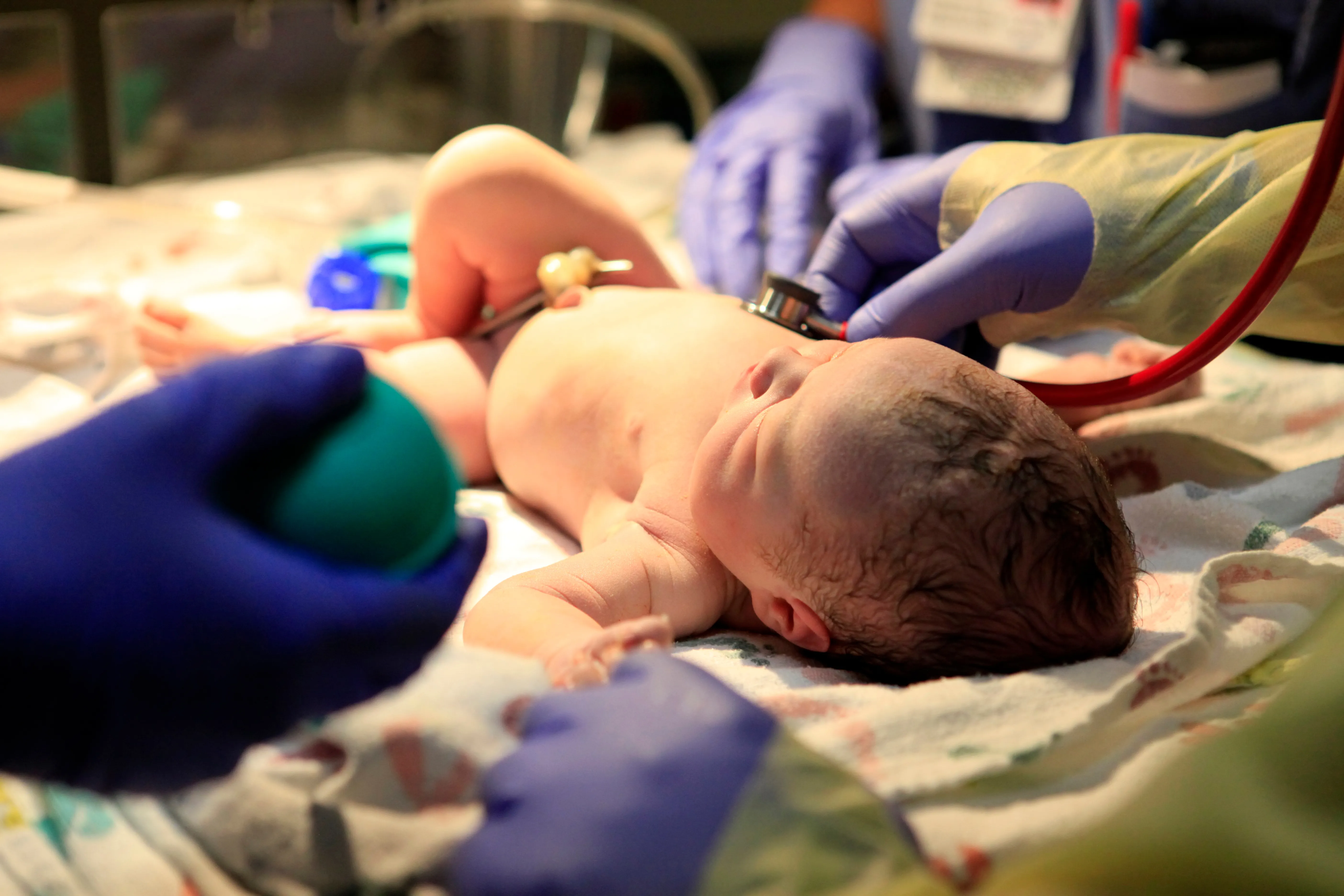 Florida Hypoxic-Ischemic Encephalopathy Lawyers