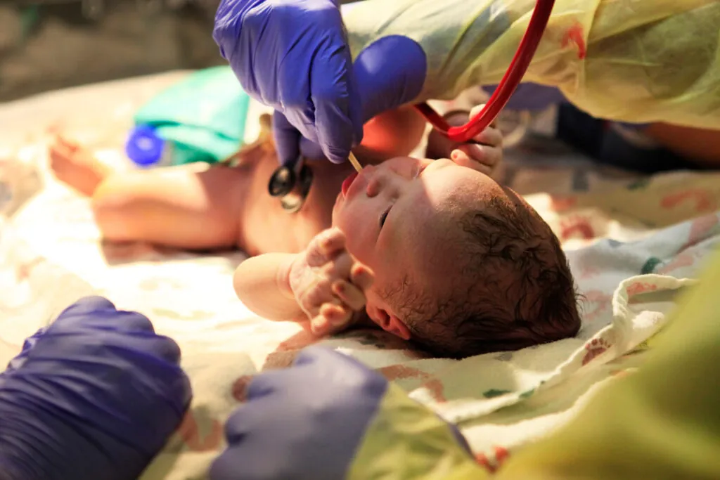 How Birth Injury Settlements Are Calculated