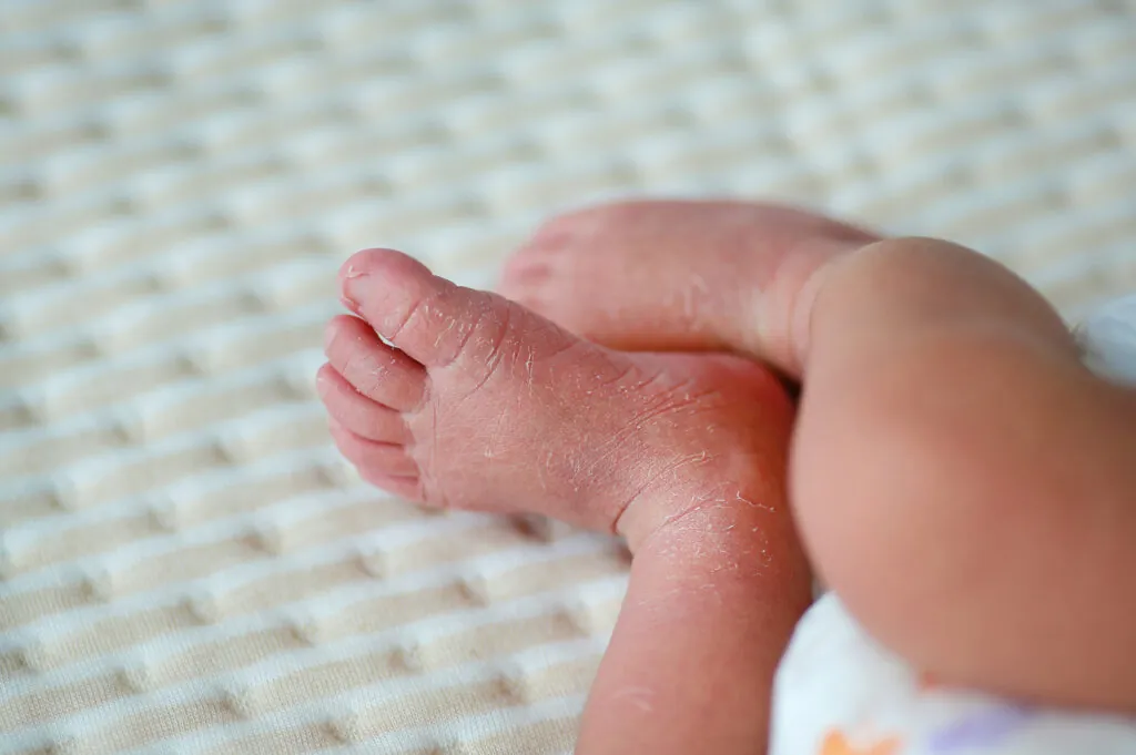 Understanding Birth Injury Lawsuits